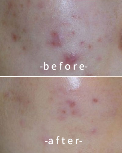 befor & after