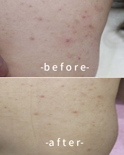 befor & after