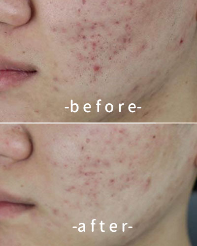befor & after