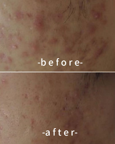 befor & after