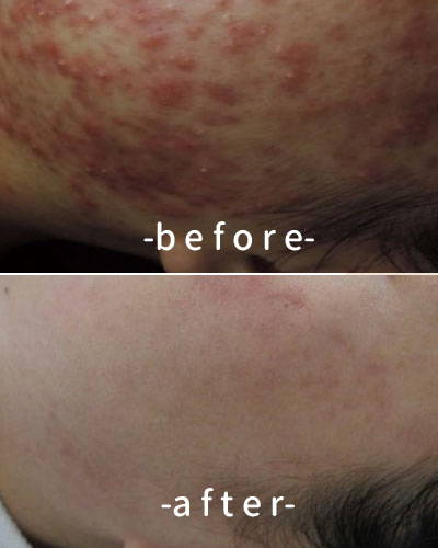 befor & after