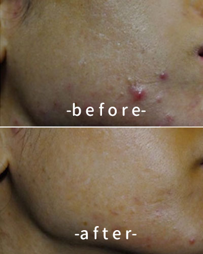 befor & after