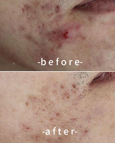 befor & after